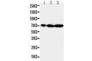 Anti-MEKK2 antibody, Western blotting Lane 1: Rat Brain Tissue Lysate Lane 2: Rat Testis Tissue Lysate Lane 3: Rat Lung Tissue Lysate
