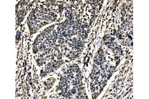 IHC analysis of SnoN/SNO/SKIL using anti-SnoN/SNO/SKIL antibody (ABIN7599455).