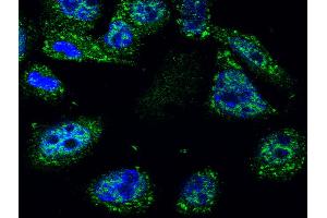 Image kindly submitted by Piotr Mamczur from Wroclaw University. (p53 Antikörper  (AA 251-310))