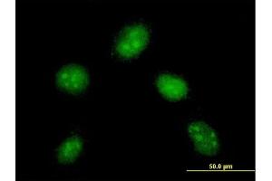 Immunofluorescence of monoclonal antibody to DYDC1 on HeLa cell. (DYDC1 Antikörper  (AA 1-177))