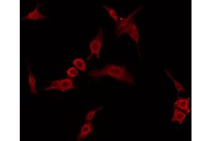 ABIN6274406 staining 293 by IF/ICC. (ARMCX2 Antikörper  (Internal Region))