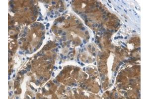 Detection of Cys-C in Human Stomach Tissue using Monoclonal Antibody to Cystatin C (Cys-C) (Cystathionine-gamma-Synthase Precursor (CYS) (AA 27-146) Antikörper)