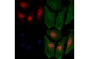 ABIN6264196 and ABIN6266654 staining  cells by IF/ICC.