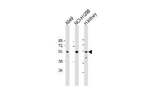 Western Blot at 1:2000 dilution Lane 1: A549 whole cell lysate Lane 2: NCI-H1299 whole cell lysate Lane 3: human kidney lysate Lysates/proteins at 20 ug per lane. (GCNT3 Antikörper  (N-Term))
