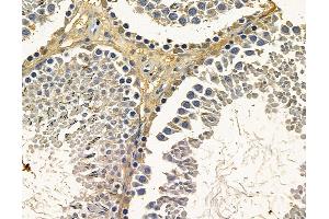 ABIN7096796 and ABIN7100862 at 1/100 staining rat testis tissue by IHC-P. (DHX37 Antikörper)