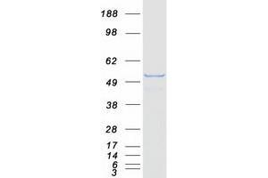Validation with Western Blot