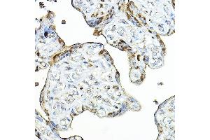 Immunohistochemistry (IHC) image for anti-Bone Marrow Proteoglycan (PRG2) (AA 17-222) antibody (ABIN3016204)