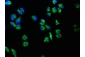 Immunofluorescence staining of Hela cells with ABIN7159477 at 1:50, counter-stained with DAPI. (TRABD2B Antikörper  (AA 195-405))