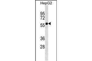 Western blot analysis in HepG2 cell line lysates (35ug/lane). (SRCRB4D Antikörper  (AA 165-191))