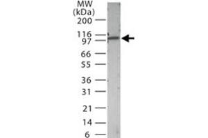 Western blot analysis of Tlr3 in 15 ug/lane mouse spleen tissue lysate with Tlr3 polyclonal antibody . (TLR3 Antikörper  (AA 135-150))