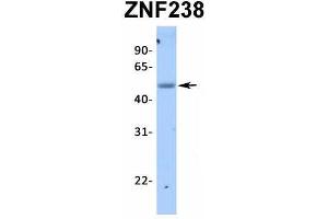 Western Blotting (WB) image for anti-Zinc Finger Protein 238 (ZNF238) (N-Term) antibody (ABIN2776459)