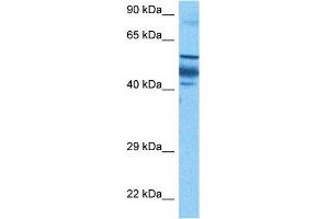 Host:  Rabbit  Target Name:  ZNF519  Sample Tissue:  Human Gallbladder Tumor lysates  Antibody Dilution:  1ug/ml (ZNF519 Antikörper  (N-Term))