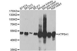 Western blot analysis of extracts of various cell lines, using ATP5A1 Antibody (ABIN5973488) at 1/1000 dilution. (ATP5A1 Antikörper)