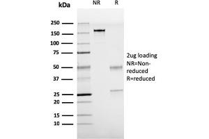 SDS-PAGE Analysis Purified TTF-1 Mouse Recombinant Monoclonal Antibody (rNX2. (Rekombinanter NKX2-1 Antikörper)
