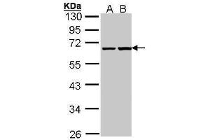 WB Image Sample (30 ug of whole cell lysate) A: A431 , B: H1299 10% SDS PAGE antibody diluted at 1:1000 (PHF1 Antikörper)
