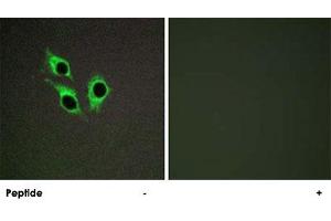 Immunofluorescence analysis of HepG2 cells, using ANO9 polyclonal antibody . (ANO9 Antikörper)