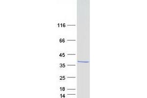 Western Blotting (WB) image for Regulatory Factor X-Associated Ankyrin Containing Protein (RFXANK) (Transcript Variant 1) protein (Myc-DYKDDDDK Tag) (ABIN2714697)