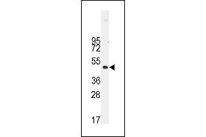 Western blot analysis of anti-Desmin Antibody (t16) (ABIN389226 and ABIN2839379) in NCI- cell line lysates (35 μg/lane). (Desmin Antikörper  (AA 1-30))