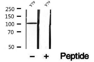Western blot analysis of extracts of Y79 cells, using SFPQ antibody. (SFPQ Antikörper  (C-Term))