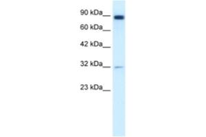 Western Blotting (WB) image for anti-Matrix Metallopeptidase 9 (Gelatinase B, 92kDa Gelatinase, 92kDa Type IV Collagenase) (MMP9) antibody (ABIN2460650) (MMP 9 Antikörper)