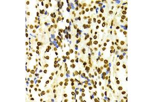 Immunohistochemistry of paraffin-embedded Rat kidney using H3K27me2 antibody at dilution of 1:100 (x400 lens). (Histone 3 Antikörper  (H3K27me))