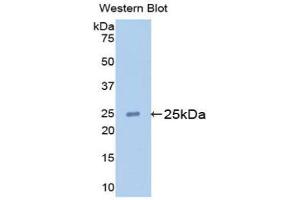 Western blot analysis of the recombinant protein. (Apolipoprotein M Antikörper  (AA 20-190))