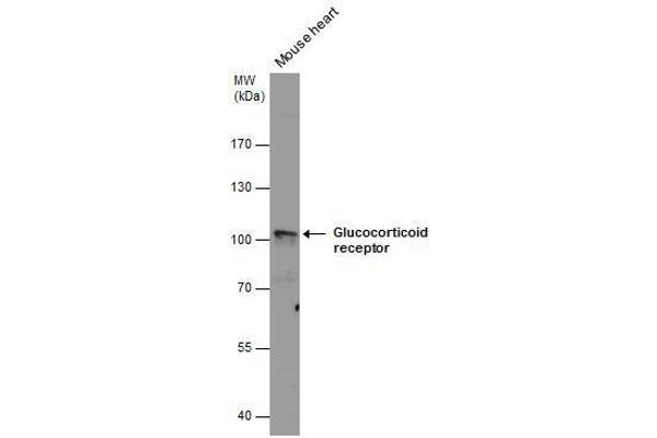 Glucocorticoid Receptor Antikörper  (N-Term)