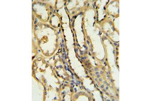 TR Antibody (N-term) 6545a IHC analysis in formalin fixed and paraffin embedded human kidney tissue followed by peroxidase conjugation of the secondary antibody and DAB staining. (CD40 Ligand Antikörper  (N-Term))
