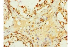 Immunohistochemistry of paraffin-embedded human testis tissue using ABIN7154932 at dilution of 1:100 (HHIP Antikörper  (AA 18-220))