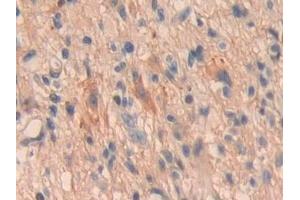 Immunohistochemistry (IHC) image for anti-Oncoprotein Induced Transcript 3 (OIT3) (AA 297-506) antibody (ABIN7434002)
