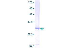 C12orf57 Protein (AA 1-126) (GST tag)