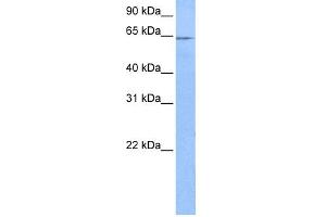 WB Suggested Anti-FAM71A Antibody Titration: 0. (FAM71A Antikörper  (C-Term))