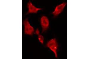 ABIN6269045 staining HeLa by IF/ICC. (CHEK1 Antikörper  (Internal Region))