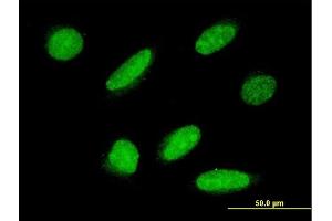 Immunofluorescence of monoclonal antibody to RPAP3 on HeLa cell. (RPAP3 Antikörper  (AA 1-631))