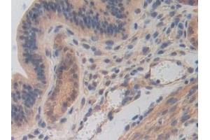 Immunohistochemistry (IHC) image for anti-Cadherin-16 (CDH16) (AA 353-617) antibody (ABIN7441937)