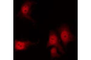 ABIN6267311 staining 293 by IF/ICC. (KRT8 Antikörper  (pSer432))