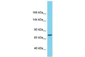 Western Blotting (WB) image for anti-Chromosome 1 Open Reading Frame 112 (C1ORF112) (C-Term) antibody (ABIN2791131) (C1orf112 Antikörper  (C-Term))