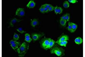 Immunofluorescent analysis of MCF-7 cells using ABIN7165213 at dilution of 1:100 and Alexa Fluor 488-congugated AffiniPure Goat Anti-Rabbit IgG(H+L) (CNIH3 Antikörper  (AA 94-138))