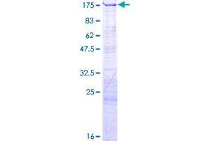 LARP1 Protein (AA 1-1019) (GST tag)