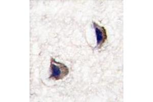 Formalin-fixed and paraffin-embedded human brain tissue reacted with NP1 (Nptx1) Antibody (Center) , which was peroxidase-conjugated to the secondary antibody, followed by DAB staining. (NPX1 Antikörper  (Middle Region))