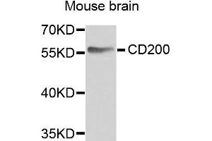 Western blot analysis of extracts of various cell lines, using CD200 antibody. (CD200 Antikörper  (AA 30-240))