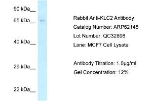 Western Blotting (WB) image for anti-Kinesin Light Chain 2 (KLC2) (C-Term) antibody (ABIN2789036) (KLC2 Antikörper  (C-Term))