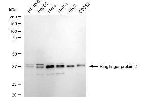 anti-Ring Finger Protein 2 (RNF2) antibody