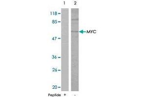Western blot analysis of extracts from ovary cancer cells , using MYC polyclonal antibody  . (c-MYC Antikörper)