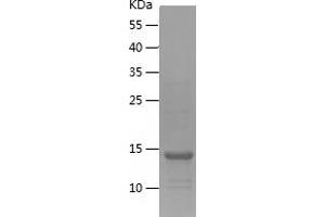 Western Blotting (WB) image for Thioredoxin-Related Transmembrane Protein 4 (TMX4) (AA 220-346) protein (His tag) (ABIN7125370) (TMX4 Protein (AA 220-346) (His tag))