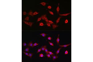 Immunofluorescence (IF) image for anti-Transporter 2, ATP-Binding Cassette, Sub-Family B (MDR/TAP) (TAP2) (AA 430-680) antibody (ABIN3022237)