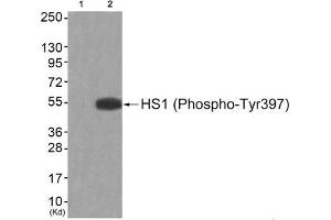 Western blot analysis of extracts from JK cells (Lane 2), using HS1 (Phospho-Tyr397) Antibody. (HCLS1 Antikörper  (pTyr397))
