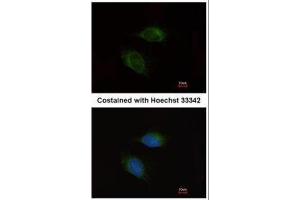 ICC/IF Image Immunofluorescence analysis of methanol-fixed HeLa, using MMP9, antibody at 1:200 dilution. (MMP 9 Antikörper)