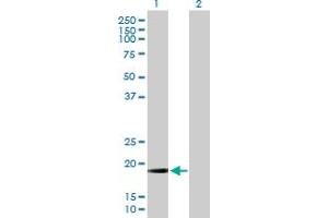 Western Blot analysis of MRPL13 expression in transfected 293T cell line by MRPL13 MaxPab polyclonal antibody. (MRPL13 Antikörper  (AA 1-178))