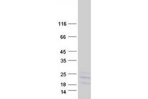 Western Blotting (WB) image for Colony Stimulating Factor 2 (Granulocyte-Macrophage) (CSF2) protein (Myc-DYKDDDDK Tag) (ABIN2722069)